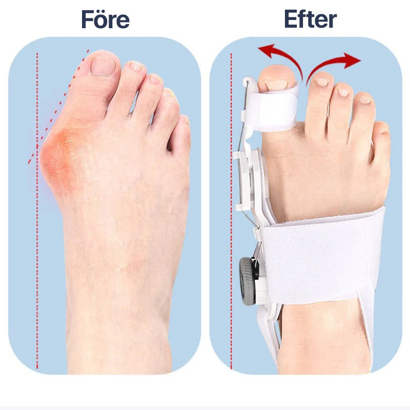 Toe Corrector for Hallux Valgus with Adjustable Support